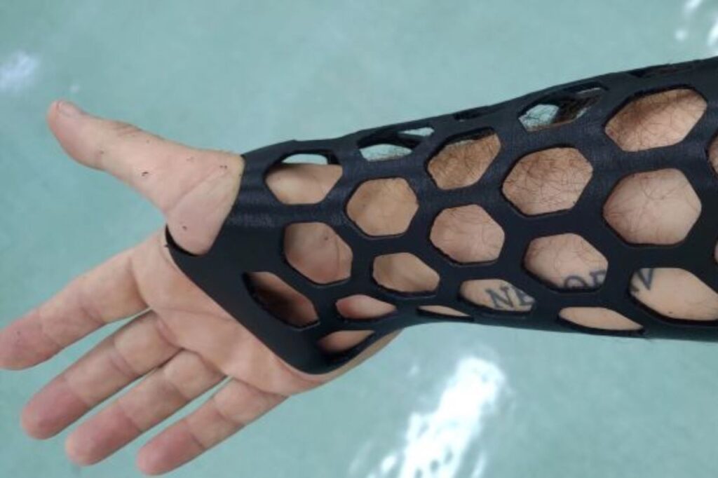Protótipo de órtese de membro superior elaborado na FEI é feito em impressora 3D e ajuda a melhorar reabilitação