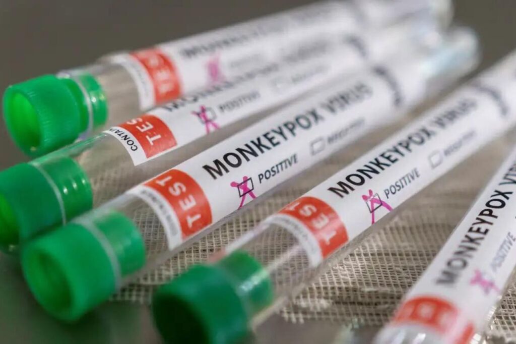 Brasil tem média de 40 a 50 novos casos de mpox por mês