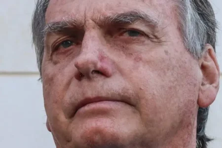 Boletim aponta estabilidade clínica de Bolsonaro, que segue internado na UTI do DF Star
