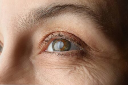 Exames periódicos de glaucoma podem evitar a cegueira