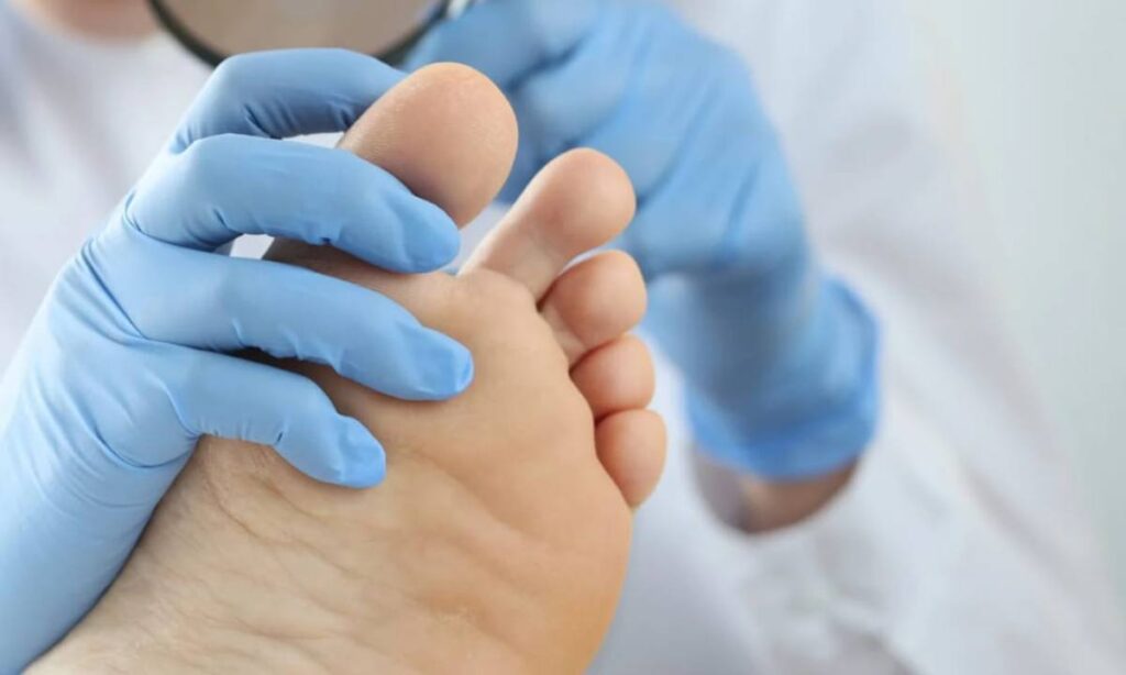 Unhas exigem cuidados especiais no inverno